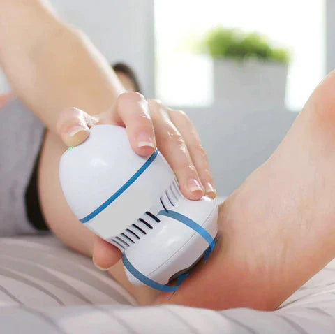 CozyCore™ Callus Remover